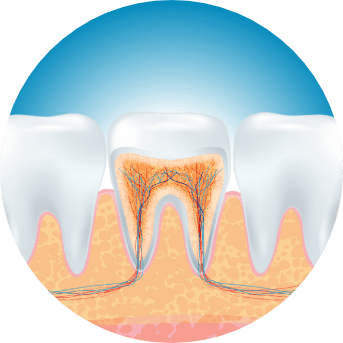 Root Canal Therapy | All About Family Dental | General & Family Dentist | SW Calgary