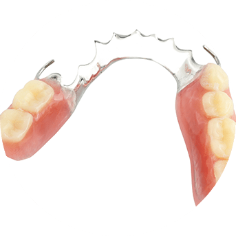 Partial Dentures | All About Family Dental | General & Family Dentist | SW Calgary