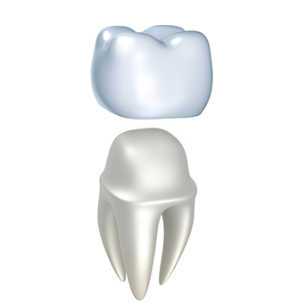 Same Day Dental Crowns | All About Family Dental | General & Family Dentist | SW Calgary
