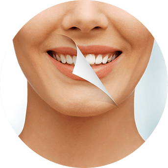 Teeth Whitening | All About Family Dental | General & Family Dentist | SW Calgary